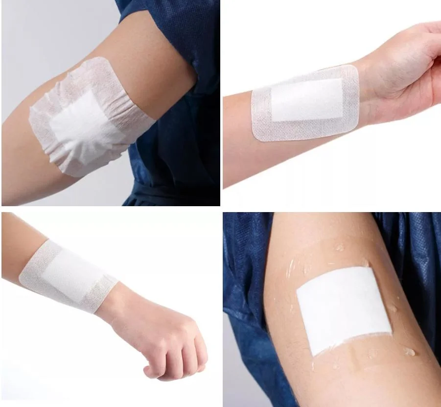 Surgical and Medical Wound Dressing Non Woven Adhesive Fixing Tape Rolls